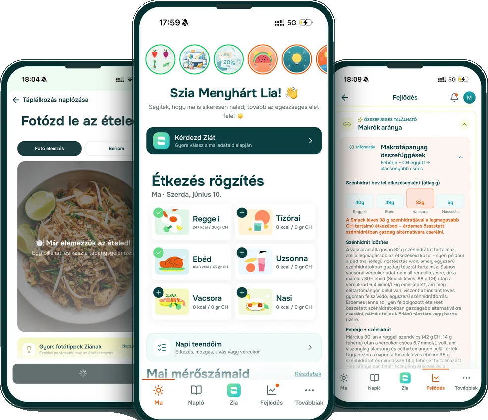A Zia app képernyői: fotós ételnaplózás, kezdőképernyő és vércukor-összefüggések